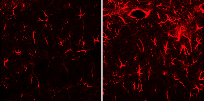 타우린에 의한 기억 담당 뇌부위(해마)의 신경교세포 활성화를 보여주는 사진. 정상 쥐(왼쪽)와 타우린을 투여한 쥐. 