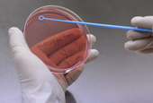 農村振興庁、世界で初めて食中毒原因菌の検出技術を開発