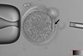 成人の体細胞を利用した胚芽幹細胞 世界初の複製成功
