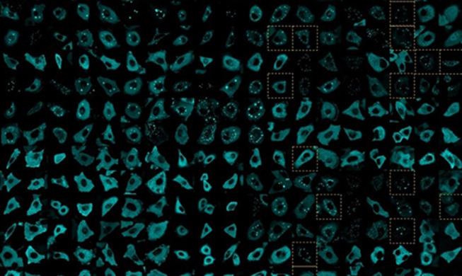 韓米共同研究チーム、がん転移の「細胞移動メカニズム」を解明